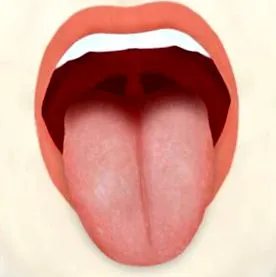 pylori
