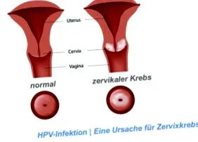 emberi