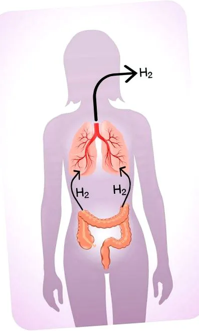 hidrogen hidrogen