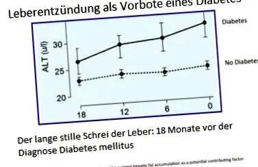 2-es típusú cukorbetegség zsírmáj