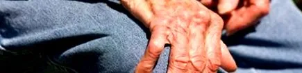 osteoarthritis
