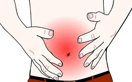 intestinală