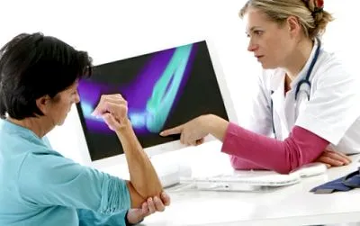 osteoartrita