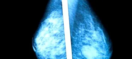 medmix