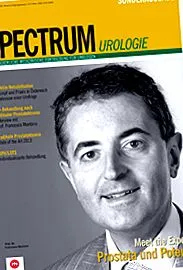 vezicii
