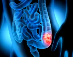 adenomatózus családi