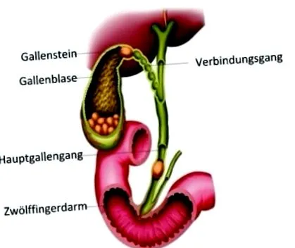 abdomed