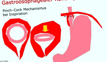 betegség