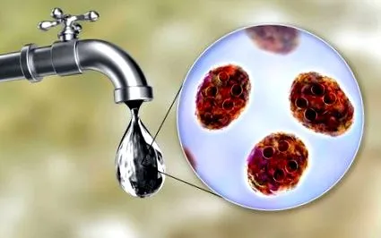 giardia