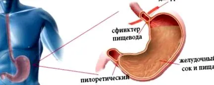 болест