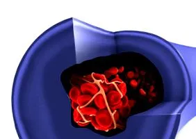 cardiology szívfogalmak