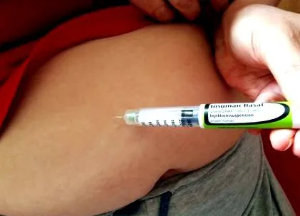 este