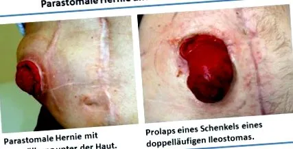 gmbh