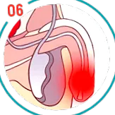 urotrin