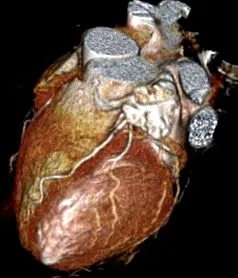 arterelor