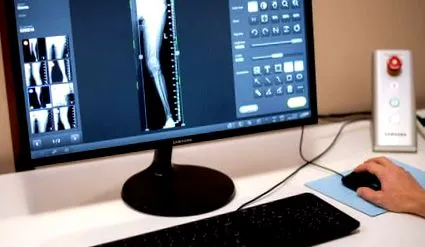 csípőprotézis