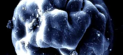 canceroase