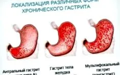 мукозна мембрана