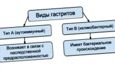 wallsидовите желудникот