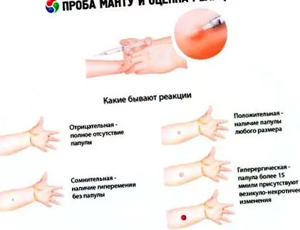 copii