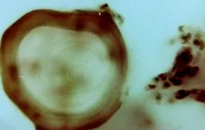 alveoláris
