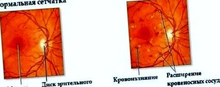 симптоми причини