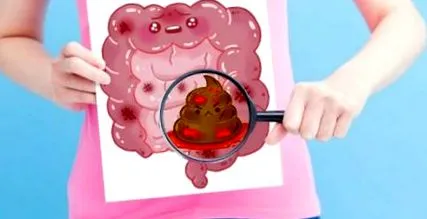 intestinală