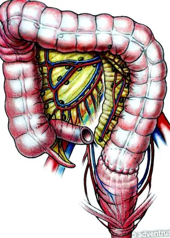 intestinul gros