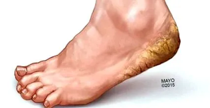 gyógyíthatják