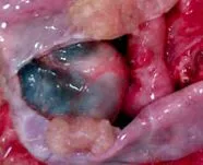 diagnostic ovarului