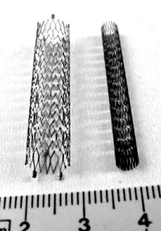 stentului
