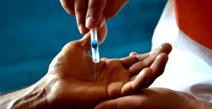 lancet lancet