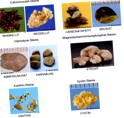 вики