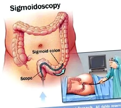 között