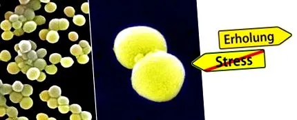 stye