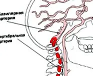 vertebro-bazilaris