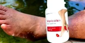 varicoles