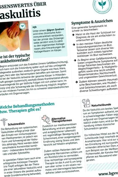 vasculitis