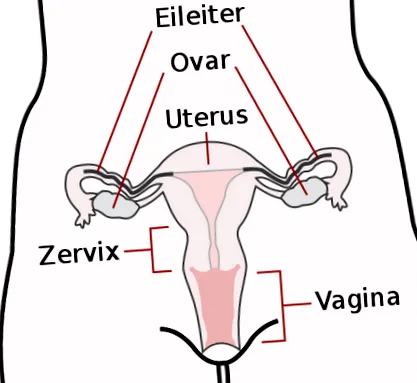 pcos