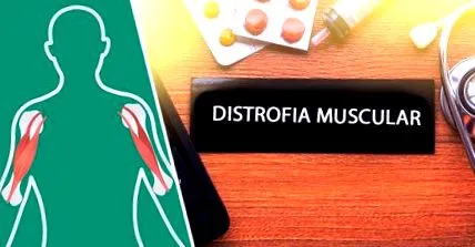 duchenne
