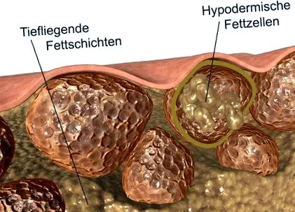 csökkentse