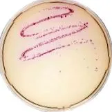 yersinia