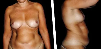 estetică