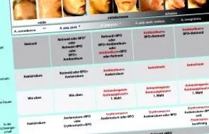 Acne vulgaris