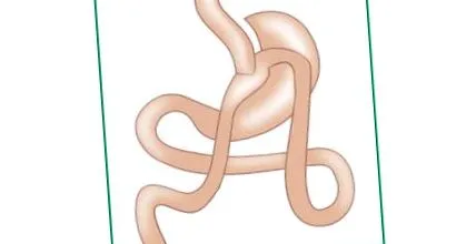supraponderal