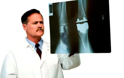 osteoarthritis
