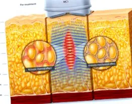 medcontour
