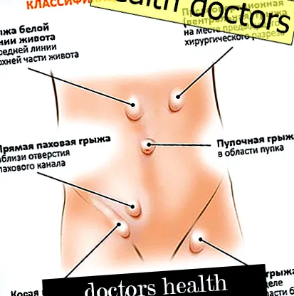 herniile