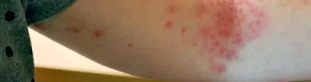 вашата кожа