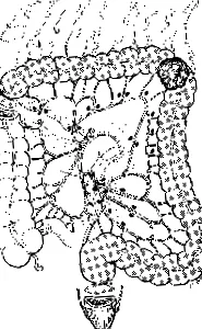 alsó mesenterialis artéria